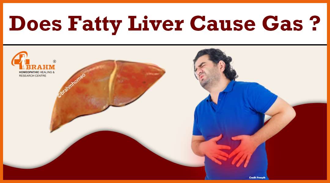 fatty liver treatment