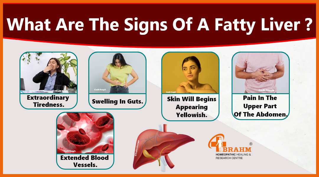 Signs-Of-A-Fatty-Liver