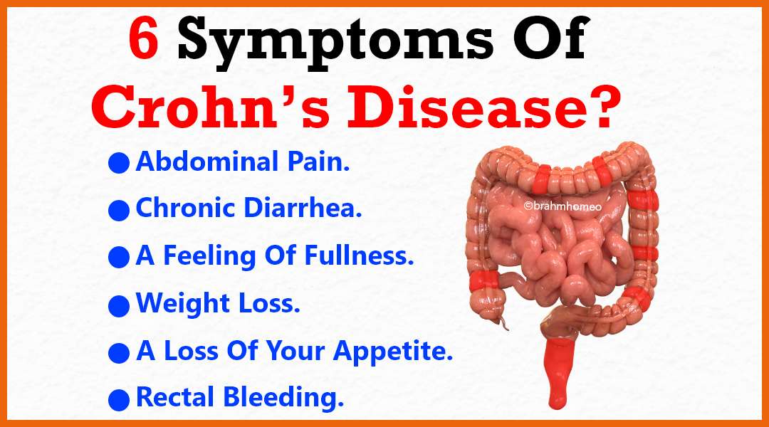 crohns disease