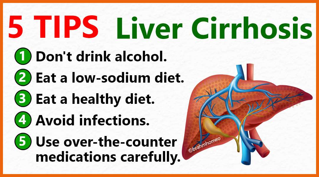 liver cirrhosis