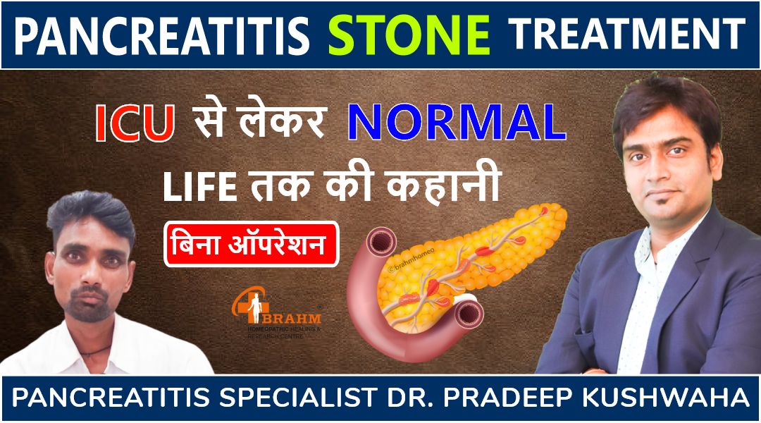 pancreatitis-stone-treatment-ICU-से-लेकर-normal-life-तक-की-कहानी